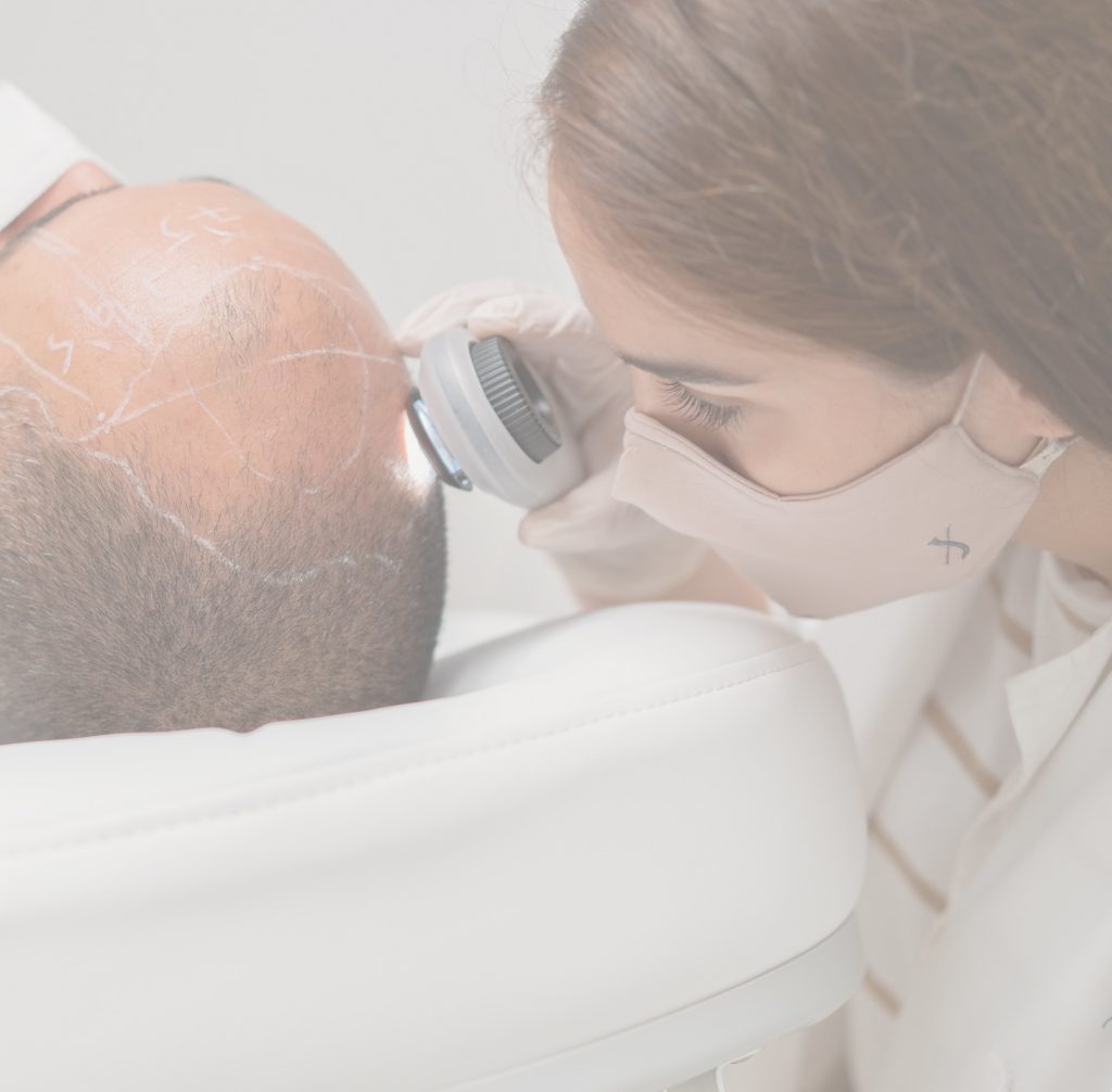 valencia trasplante capilar alejandria clinica valencia