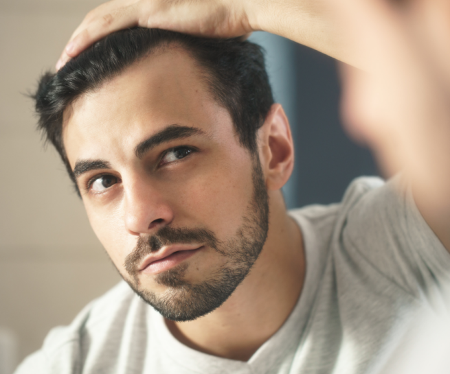 ¿a qué edad puedo hacerme un trasplante capilar?