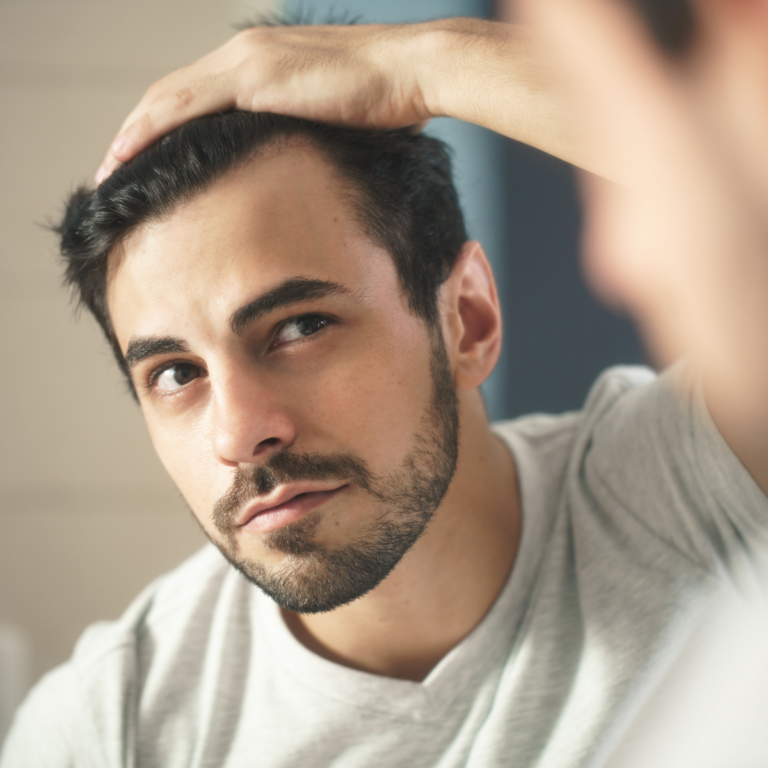 ¿a qué edad puedo hacerme un trasplante capilar?